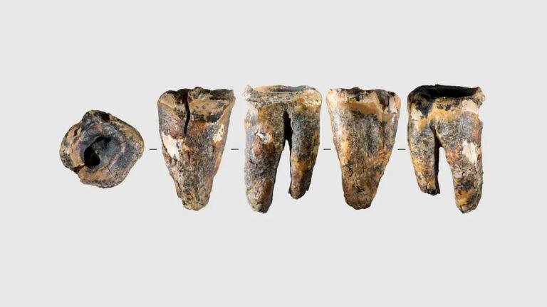 59-bin-yillik-azi-disi-tip-dunyasini-sasirtti-VqyLN4Rr